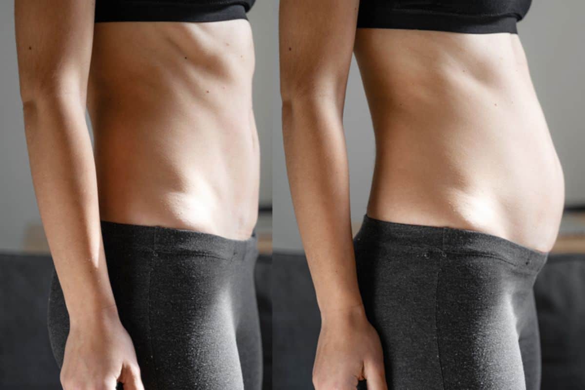 How long does diastasis recti take to improve Beckton?