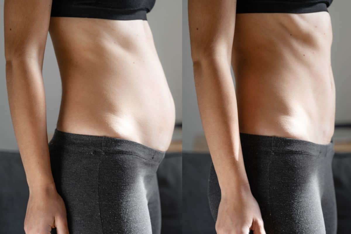 Post-Pregnancy: What Happens to Your Abdominal Muscles After Birth Beckton