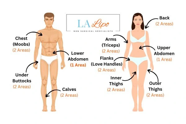 LA LIPO Cryolipolysis Areas Beckton