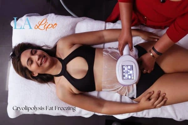 woman getting cryolipolysis Beckton