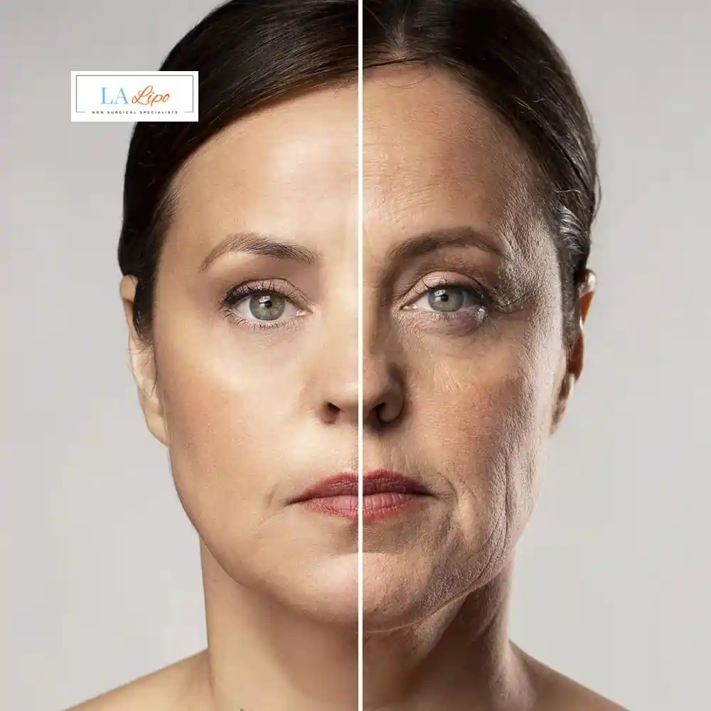 How Can You Tell If Non-Surgical Skin Tightening Is Right for You Beckton?