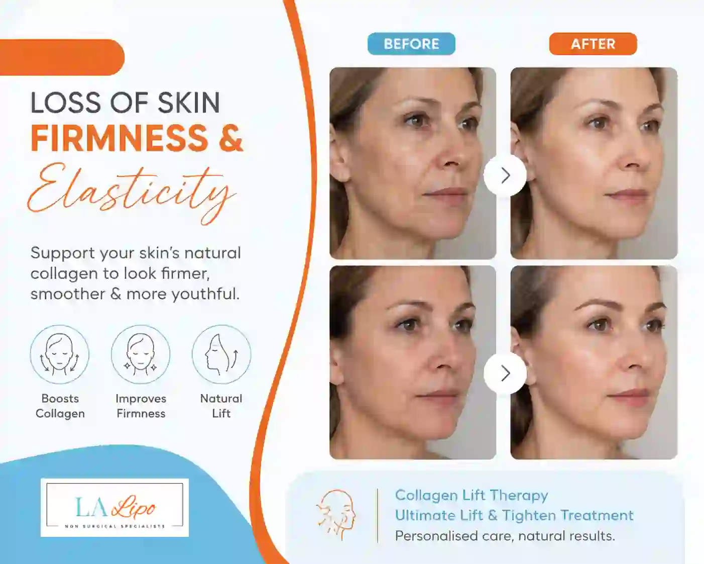 Sign #7: Loss of Skin Firmness and Elasticity Beckton