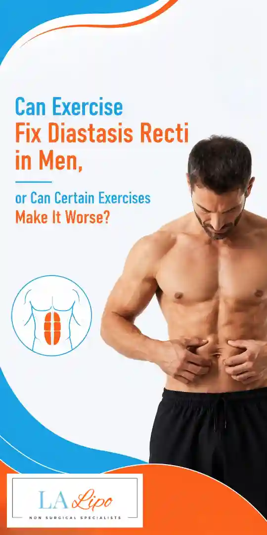 Can Exercise Fix Diastasis Recti in Men, or Can Certain Exercises Make It Worse Beckton?